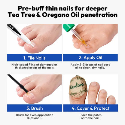 🔥Black Friday Deal｜1 Set Electric Nail Drill for Thick Nails, Cordless Efiles for fungal Nails Lightweight
